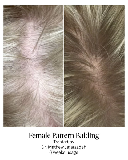 Advanced Hair System