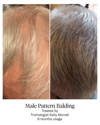 Advanced Hair System